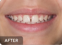 Illustrative family dental care after example