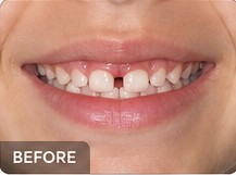 Illustrative family dental care before example